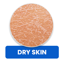 Dry-Skin