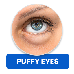 Puffy Eyes